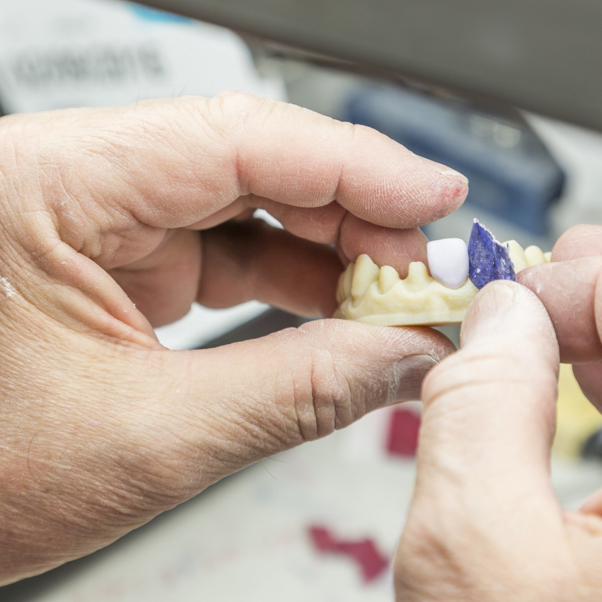 PROSTHODONTICS AND RESTORATIVE DENTISTRY