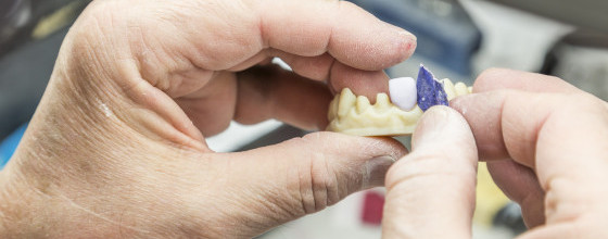 PROSTHODONTICS AND RESTORATIVE DENTISTRY